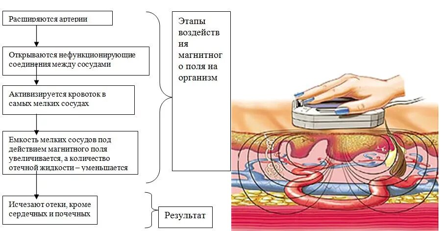 Локальное воздействие постоянного магнитного поля на человека. Принцип действия магнитотерапии на организм человека. Магнитотерапия схема магнитного поля. Магнитотерапия схема воздействия. Механизм действия магнитотерапии на организм человека.