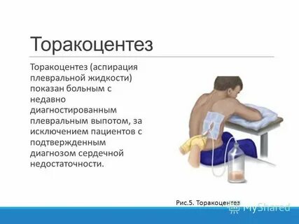 Осложнениями плевральной пункции являются