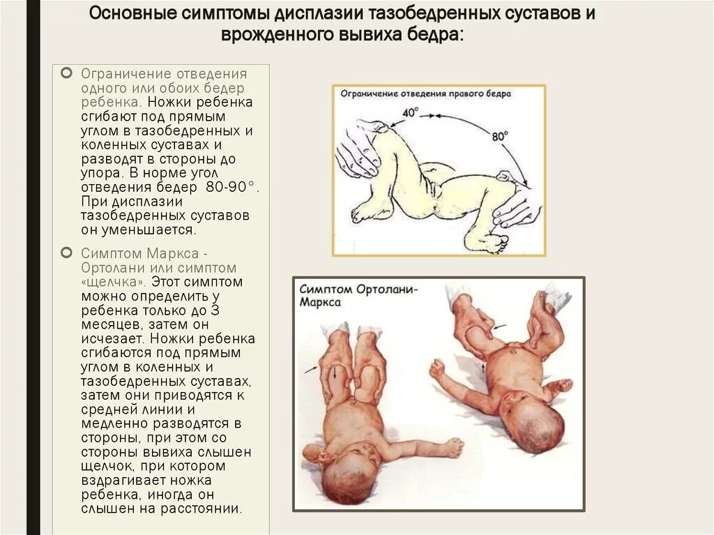 Наличия дисплазии. Симптом щелчка при врожденном вывихе бедра. Дисплазия тазобедренных норма. Дисплазия тазобедренных суставов у новорожденных 4 месяца. Профилактика дисплазии тазобедренных суставов у грудничков.