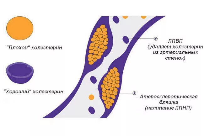 Как повысить лпвп. Холестерин. Хороший холестерин. Плохой и хороший холестерин. Профилактика холестерина в крови.