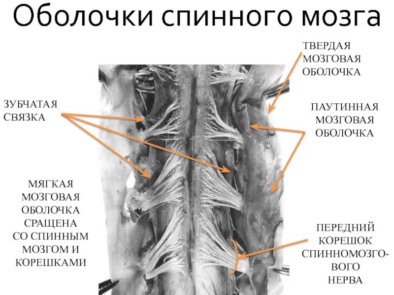 Твердая паутинная и мягкая оболочка спинного мозга. Мягкая оболочка спинного мозга строение. Строение твердой оболочки спинного мозга. Зубчатые связки спинного мозга анатомия.