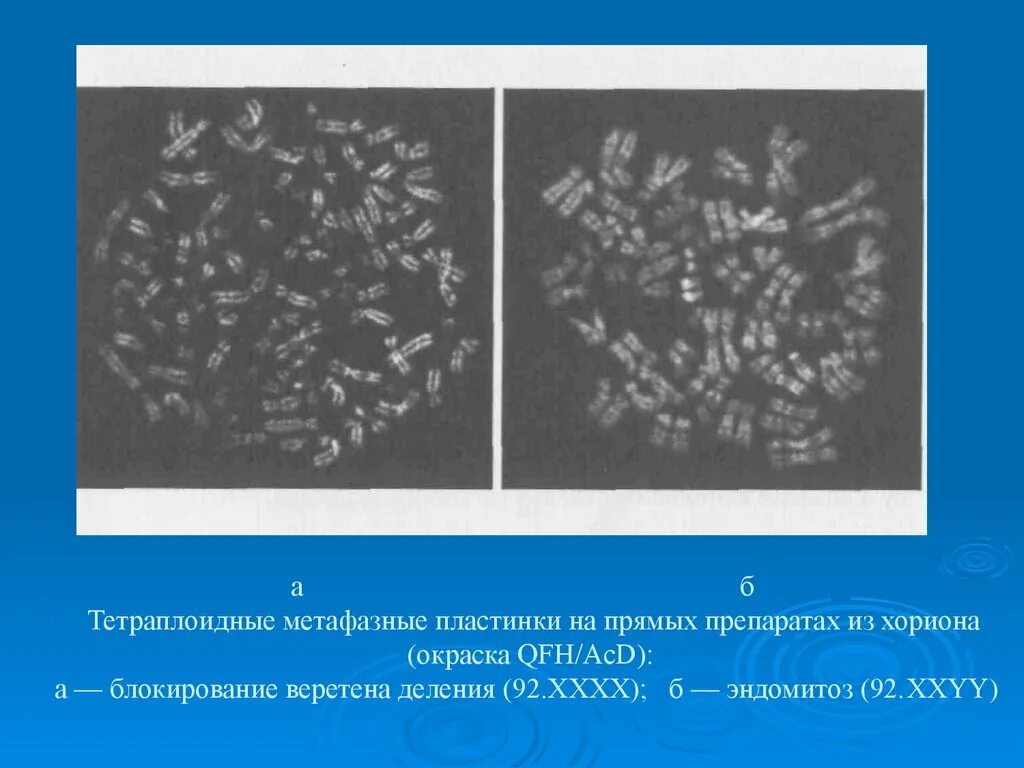 Деление тетраплоидной клетки. Метафазная пластинка. Метафазная пластинка полиплоидия. Метафазная пластинка человека препарат. Метафазная пластинка фото.