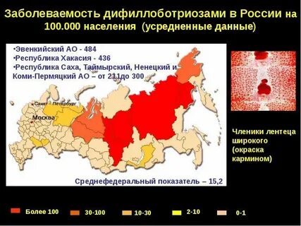 Заболеваемость в тюмени сегодня