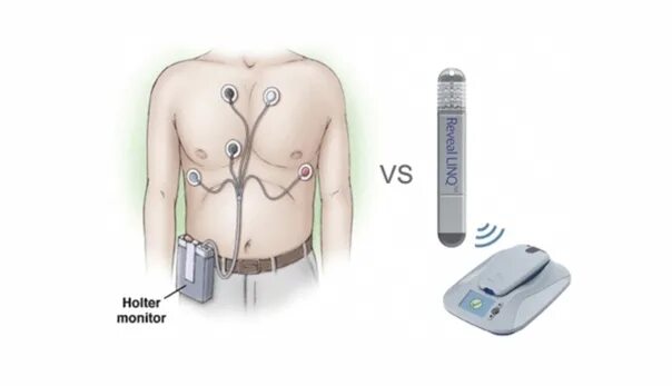 Now in INVITRO Holter monitoring + SMAD (daily monitoring of blood pressure) at 