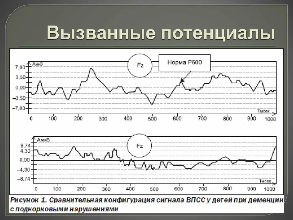 Потенциал ээг. Метод вызванных потенциалов головного мозга. Метод вызванных потенциалов головного мозга показания. Методика регистрации вызванных потенциалов. Вызванные потенциалы ЭЭГ.