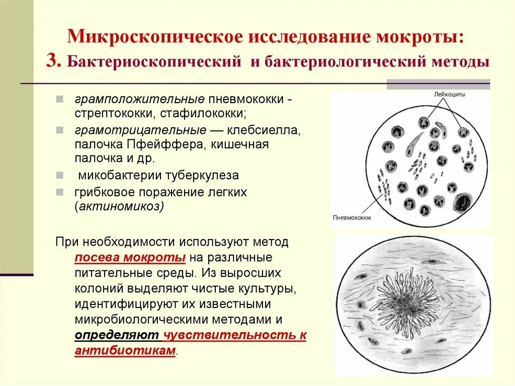 Микроскопия мокроты на микобактерии. Нативный мазок мокроты микроскопия. Микроскопический метод исследования мокроты. Бактериоскопический метод исследования мокроты.