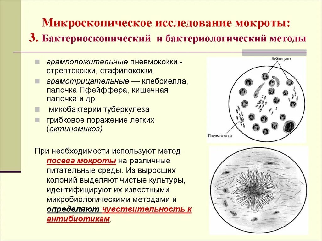 Большое отделение мокроты. Микроскопия мокроты на микобактерии. Нативный мазок мокроты микроскопия. Микроскопический метод исследования мокроты. Бактериоскопический метод исследования мокроты.