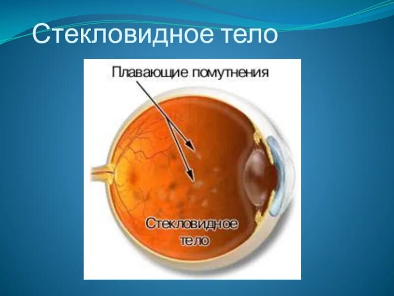 Значение стекловидного тела. Строение стекловидного тела гистология. стекловидное тело глаза плавающие. стекловидное тело капли. стекловидное тело глаза гистология.