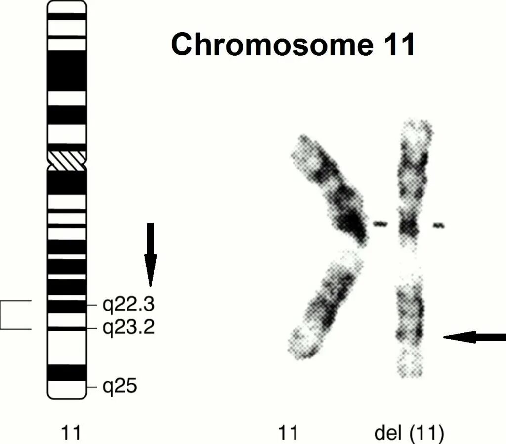 Водоросли хромосомы. 11q13 хромосома. 11 Хромосома человека. 12 Хромосома человека.
