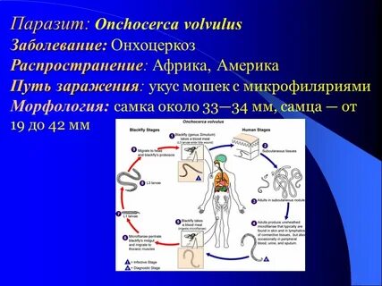 Онхоцеркоз