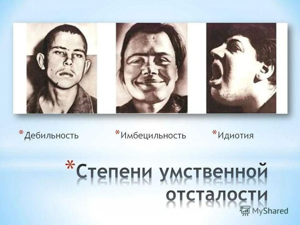 Страдающий умственной отсталостью. Классификация дебильность Имбецильность идиотия. Классификация умственной отсталости идиотия. Олигофрения в степени дебильности. Степени умственной отсталости дебильность Имбецильность идиотия.