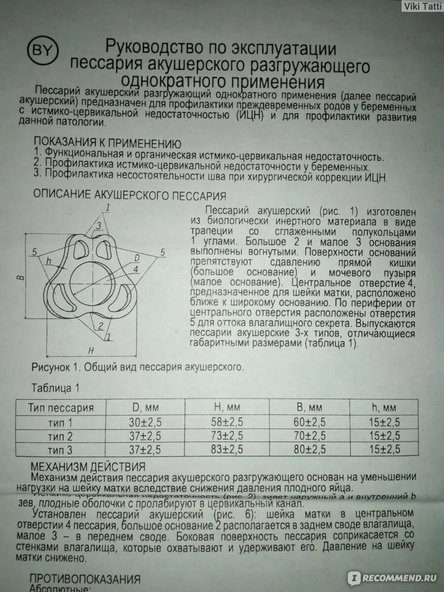 37 недель пессарий. Акушерский пессарий 2. Акушерский разгружающий пессарий. Акушерский разгружающий пессарий 1.