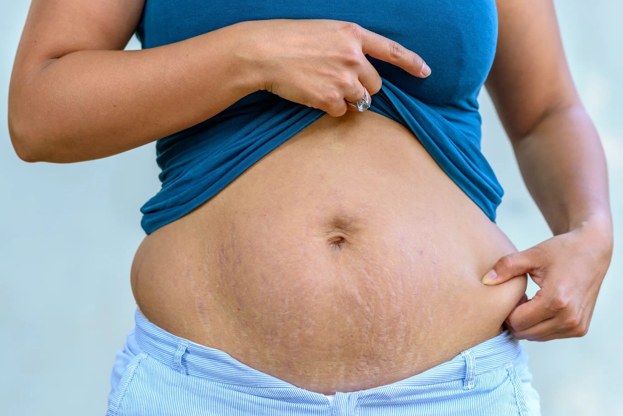 После беременности. Женщина с животиком. Большой живот у женщин после родов.