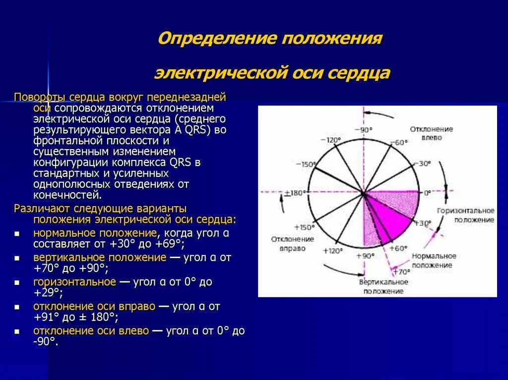 Положение электрической оси ЭКГ. Положение электрической оси сердца (ЭОС), определяют. Электрическая ось сердца угол Альфа. Электрическая ось сердца (ЭОС) на ЭКГ. Сердце отклонено вправо