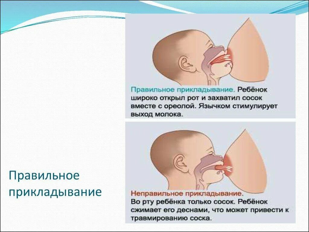 Грудное вскармливание уплотнение