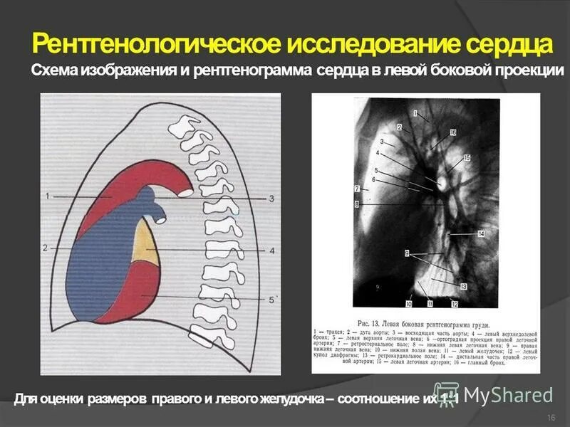 Левая боковая проекция. Прямой левой боковой проекции. Рентген органов грудной клетки в правой боковой проекции. Рентгенография грудной клетки боковая проекция. Левая боковая проекция легких.