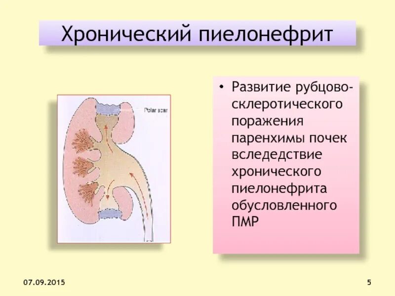 Паренхима почки что это