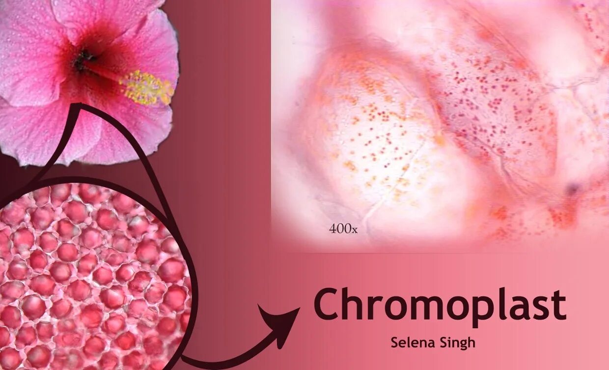 Микрофотография хромопласта. Хлоропласт микрофотография. Хромопласты в клетках мякоти томата. Лейкопласты микрофотография. Хромопласты под микроскопом.