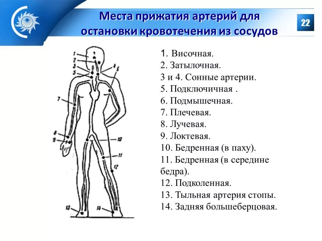 Точки прижатия артерий схема. Места прижатия артерий при кровотечениях. Точки прижатия артерий для остановки кровотечения из сосудов. Схема точек при пальцевом прижатии для остановки кровотечения.