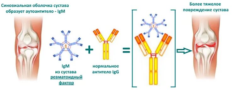 Ревматоидный фактор форум. Аутоантитела ревматоидный артрит. Ревматоидный фактор 6.2 ме/мл. Ревматоидный фактор 20.0 расшифровка. Ревматоидный фактор IGM что это.