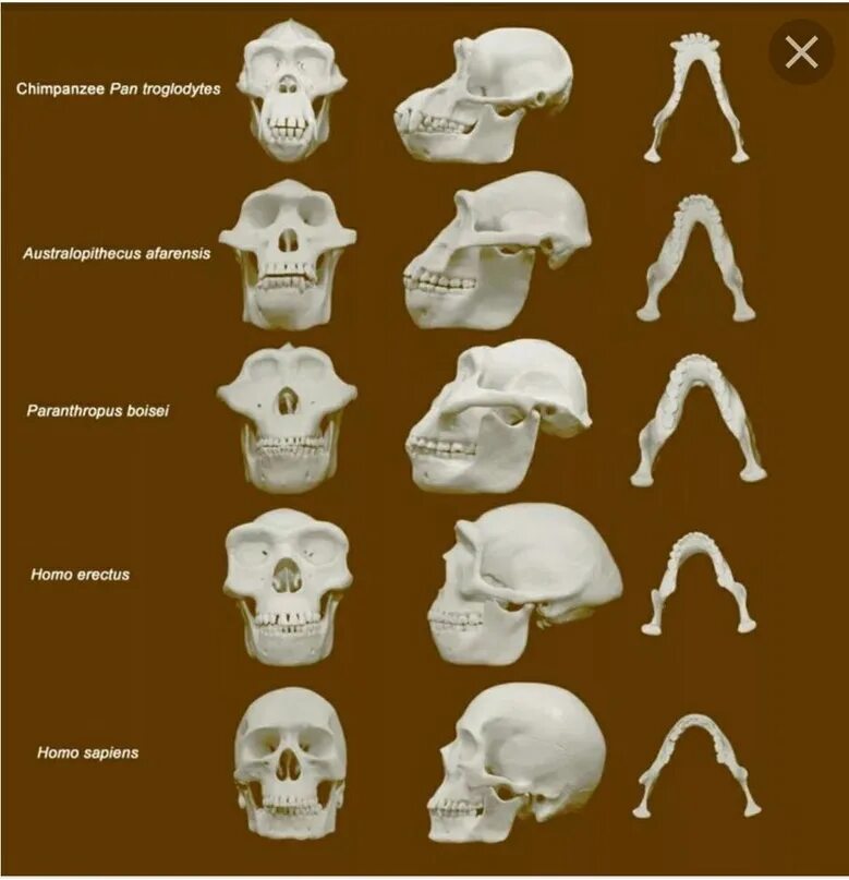 Эволюция развития мозга. Черепа австралопитека и хомо сапиенс. Австралопитек анатомия. Эволюция человека хомо сапиенс.
