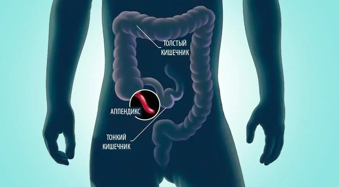 Тянет аппендицит. Где находится аппендикс. Где находитсяаапендикс. Фото аппендикса расположение.