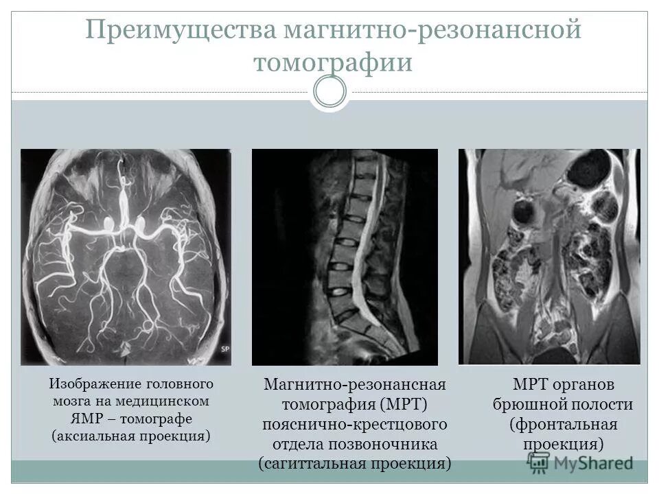 Программа для чтения мрт. Проекции мрт мозга. фронтальная проекция мрт. проекции кт. аксиальная проекция мрт.