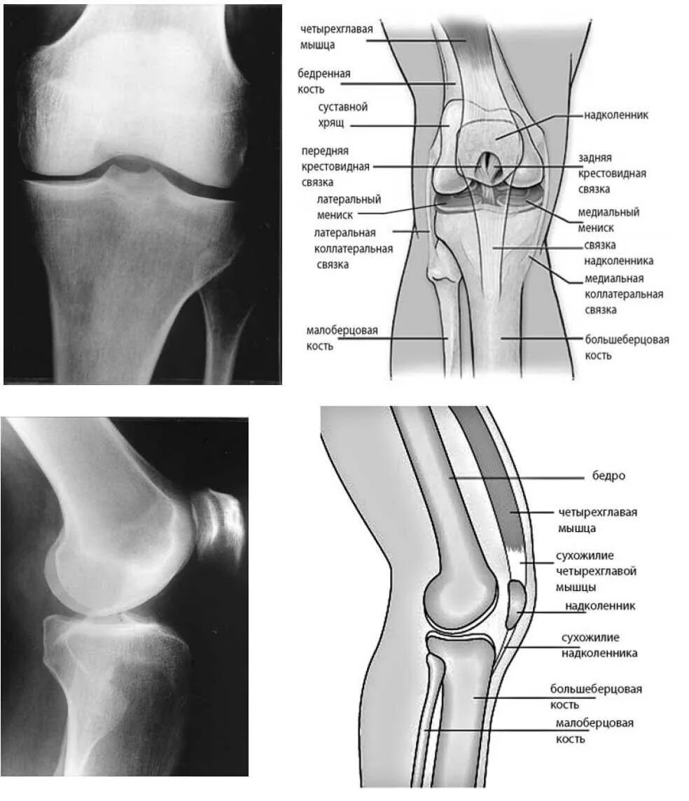 Медиальный мыщелок бедра. Строение коленного сустава рентген. Анатомия большеберцовой кости коленного сустава. Периостит коленного сустава рентген. Коленный сустав строение анатомия рентген.