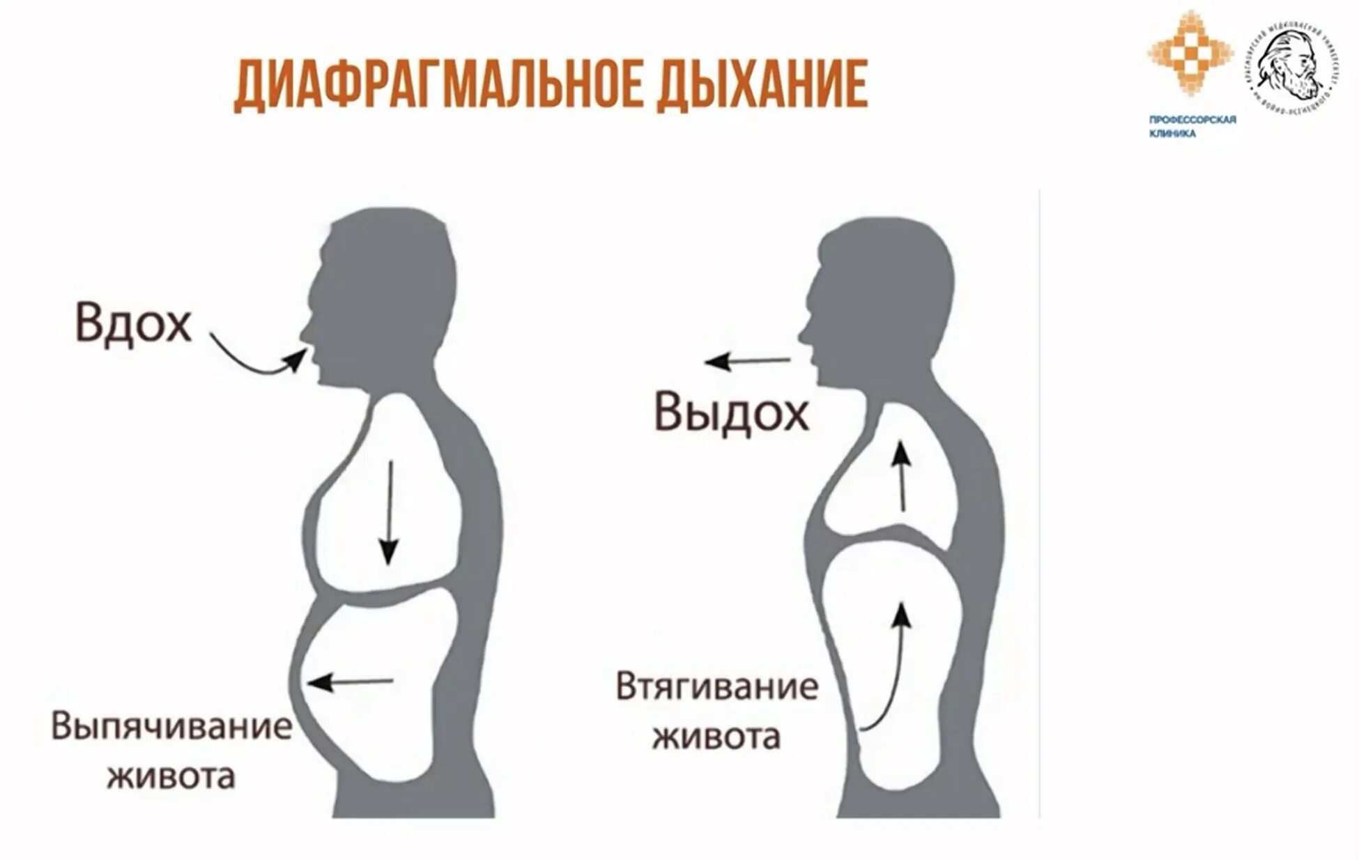 Дышать после ковида. Диафрагмальное дыхание. Техника дыхания. Методика брюшного дыхания. Техника дыхания диафрагмой.