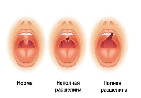 Пастью морфологический