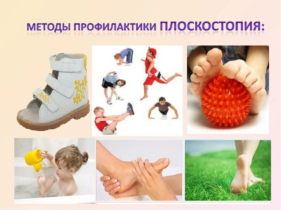 Профилактика плоскостопия. Методы профилактики плоскостопия у детей. Методы профилактики плоскостопия. Памятка по профилактике плоскостопия. Методы профилактики плоскостопия у детей.