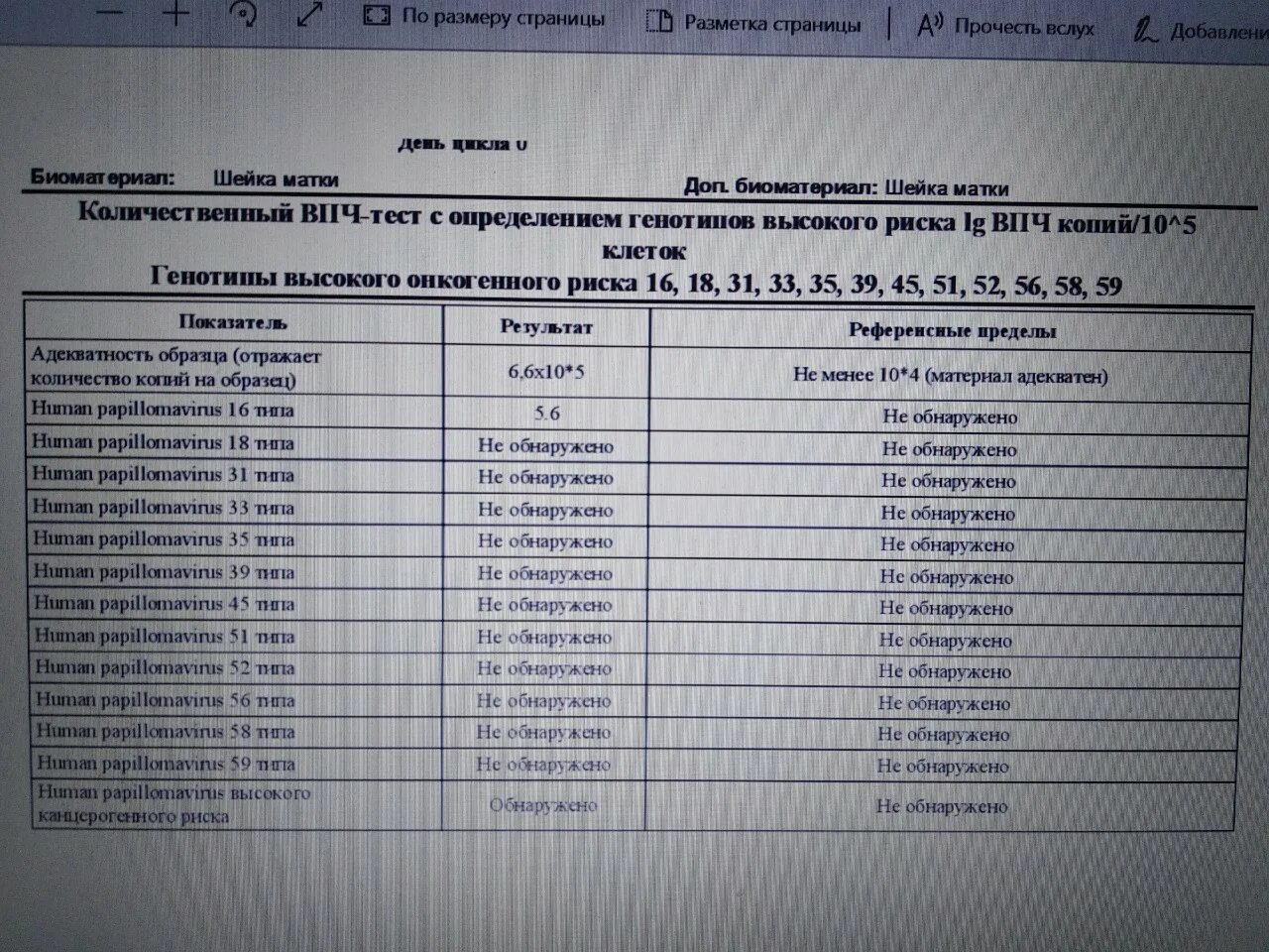 Впч расшифровка результатов. ВПЧ 16 типа количественный показатель 6.3. ВПЧ 21 Тип колич. ВПЧ 16 Тип количественный анализ. Папилломавирус анализ.