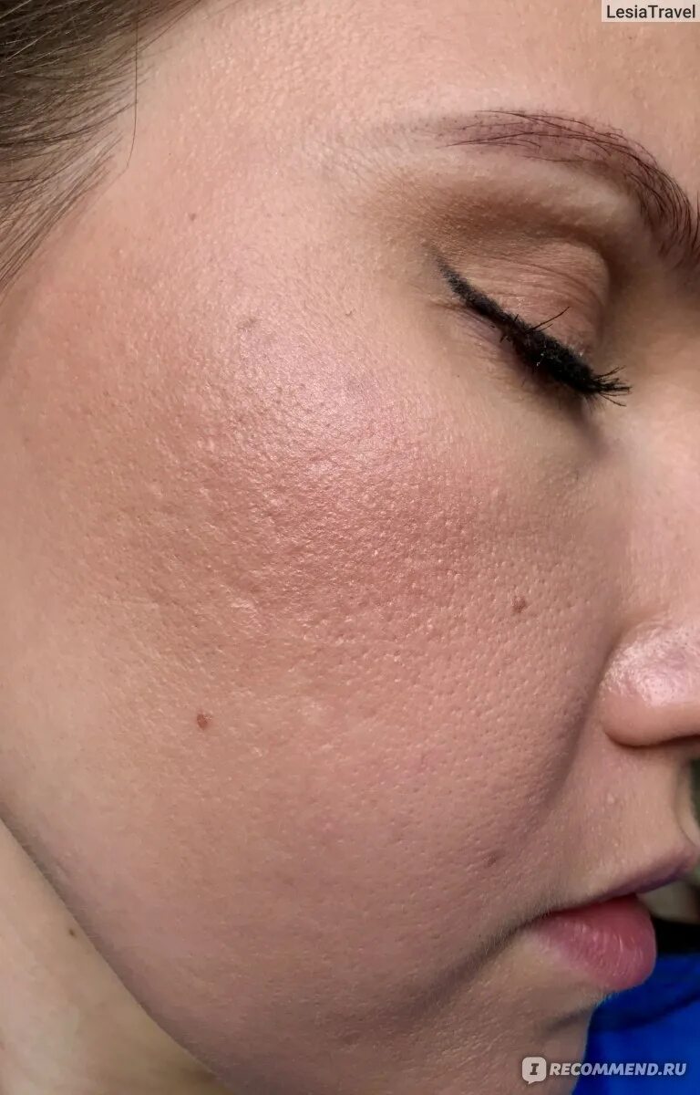 Комбинированная кожа лица. Лицо девушки. Комбинированная кожа лица. Тонкая комбинированная кожа. Комбинированная кожа лица.