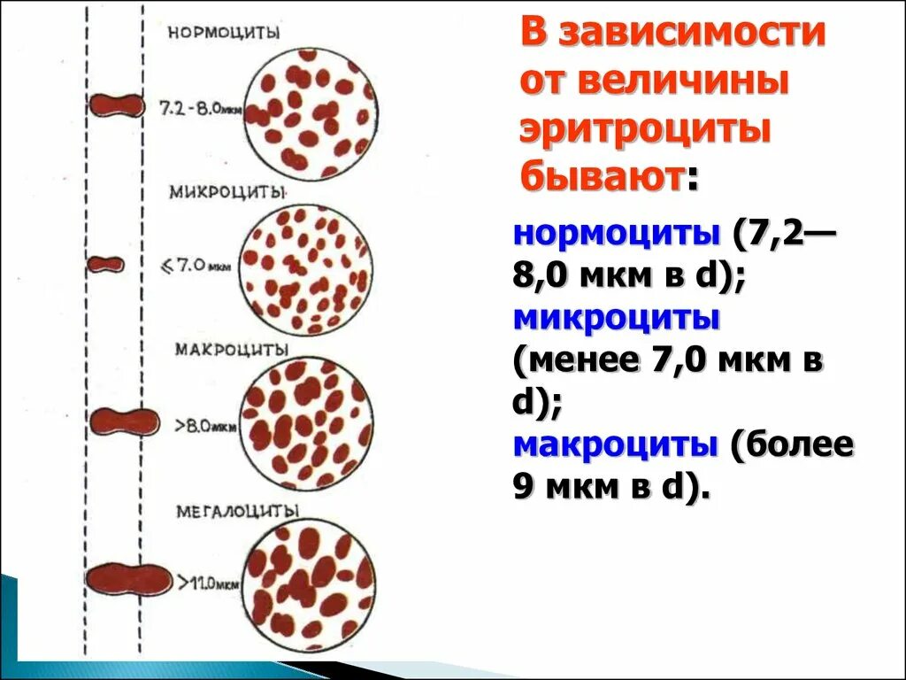 Пониженные макроциты. Нормоциты. Микроциты макроциты мегалоциты. Заболевания системы крови. Диаметр нормоцита.