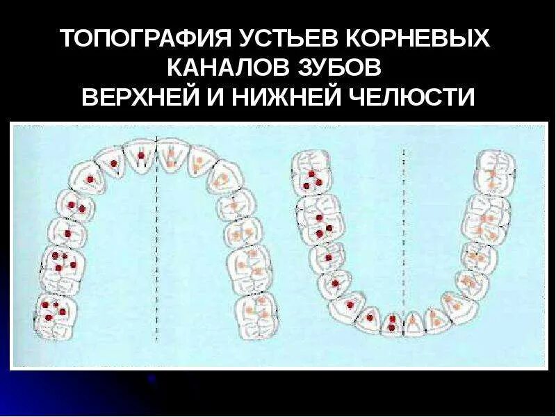 Схема расположения устьев корневых каналов в молочных зубах. Устье корневых каналов зубов верхней и нижней челюсти. Топография корневых каналов 36 зуба.