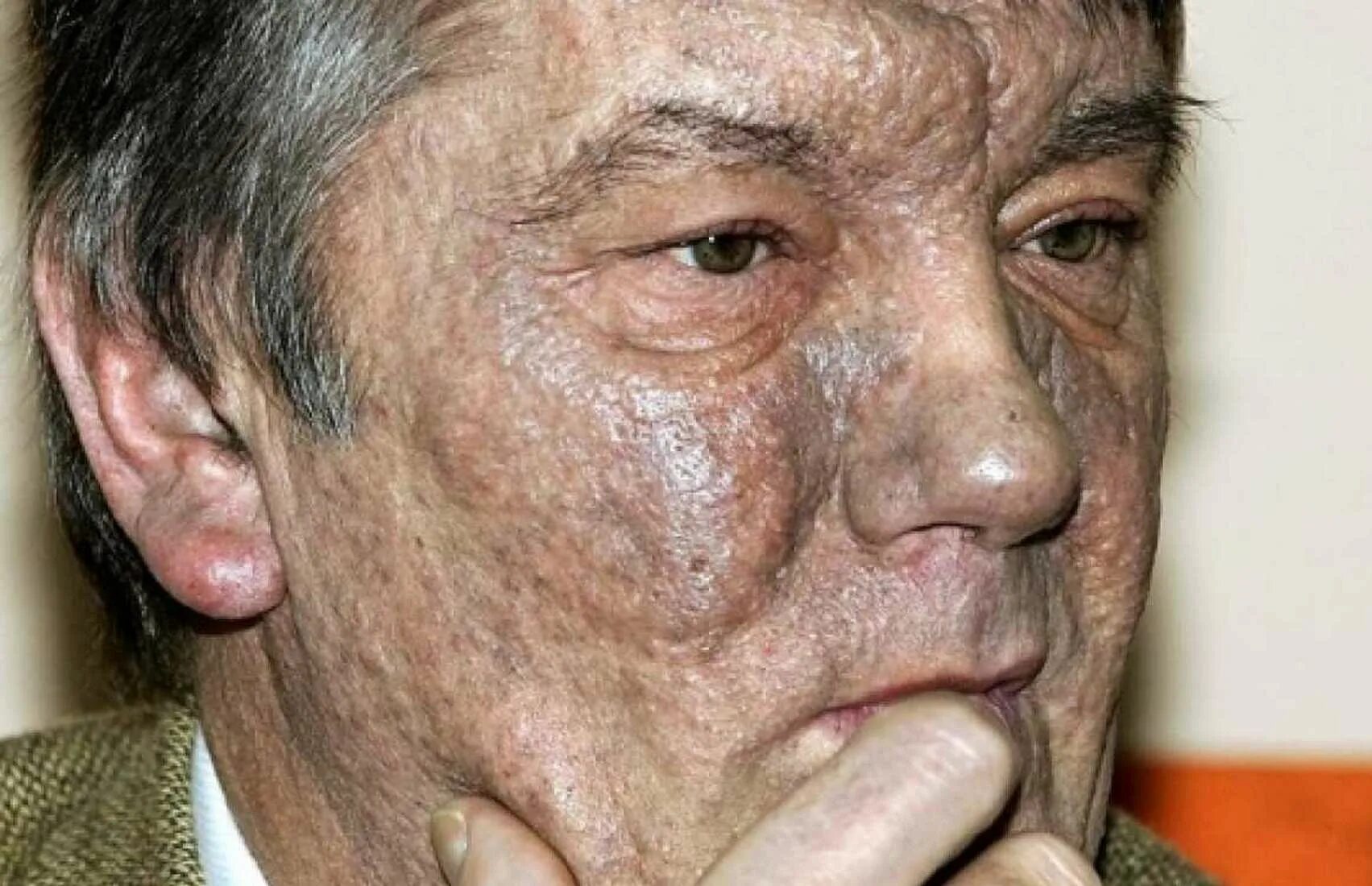Какое нибудь заболевание