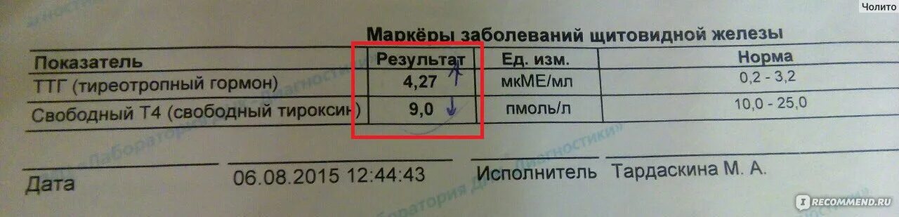 Т4 норма у женщин 60. Гормоны щитовидной железы т4 Свободный и ТТГ. Нормы гормонов ТТГ И т4. Гормоны щитовидной железы т3 и т4 Свободный норма у женщин. Нормы гормонов ТТГ т4 св.