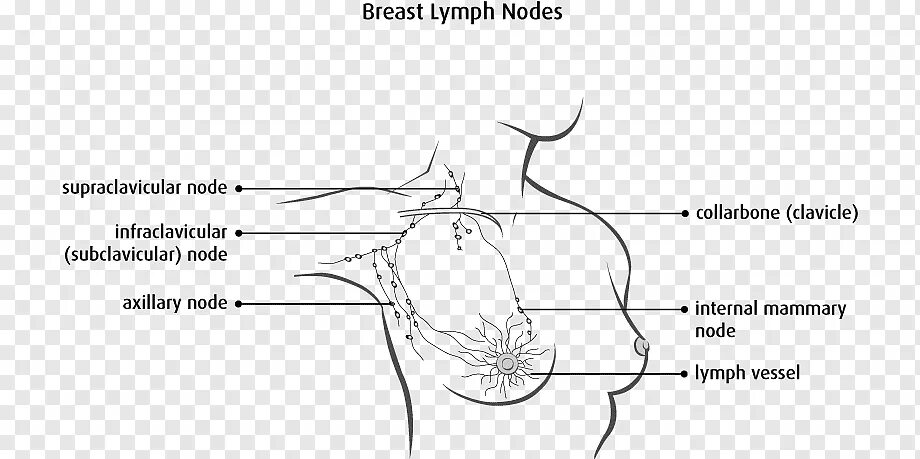Лимфоузлы под мышками расположение у женщин. Схема расположения лимфоузлов подмышками. Расположение лимфатических узлов в подмышечной впадине. Supraclavicular лимфоузлы. Подмышечные лимфатические узлы у мужчин.