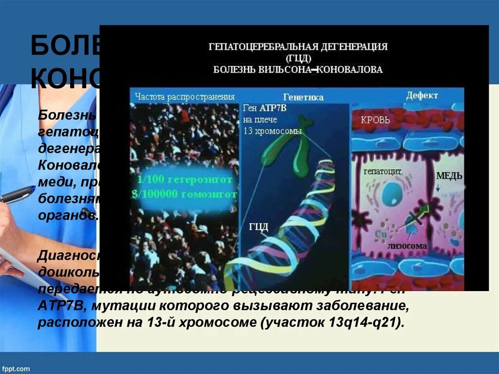 Ген заболел. Гепатоцеребральная дегенерация Вильсона-Коновалова. Гепатоцеребральная дистрофия (болезнь Вильсона-Вестфаля-Коновалова).. Болезнь Вильсона Коновалова ген. Болезнь Вильсона — Вестфаля — Коновалова.