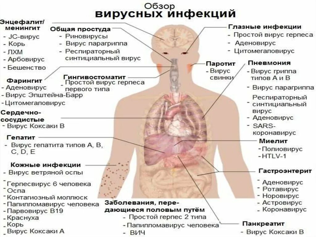 Вирусные заболевания. Вирусные инфекции заболевания. Вирусное в заболевание вирусное заболевание. Болезни человека список. 3 вирусных заболеваний человека