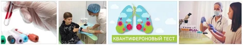 Квантифероновый тест положительным. Квантифероновый тест. квантофероноыфй тест. квантифероновый тест фото. квантифероновый тест интерпретация результатов.