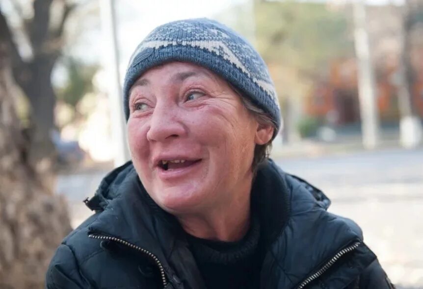 Пропитое лицо. Европейские женщины. Пропитое лицо. Ботокс для мужчин до и после. Пропитое лицо.