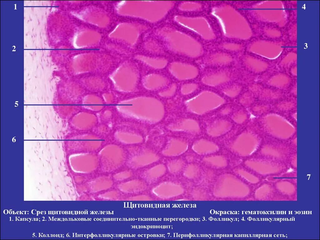 Щитовидная железа микропрепарат гистология. Щитовидная железа собаки гистология препарат. Щитовидная железа препарат гематоксилин-эозин гистология. Срез щитовидной железы гистология.