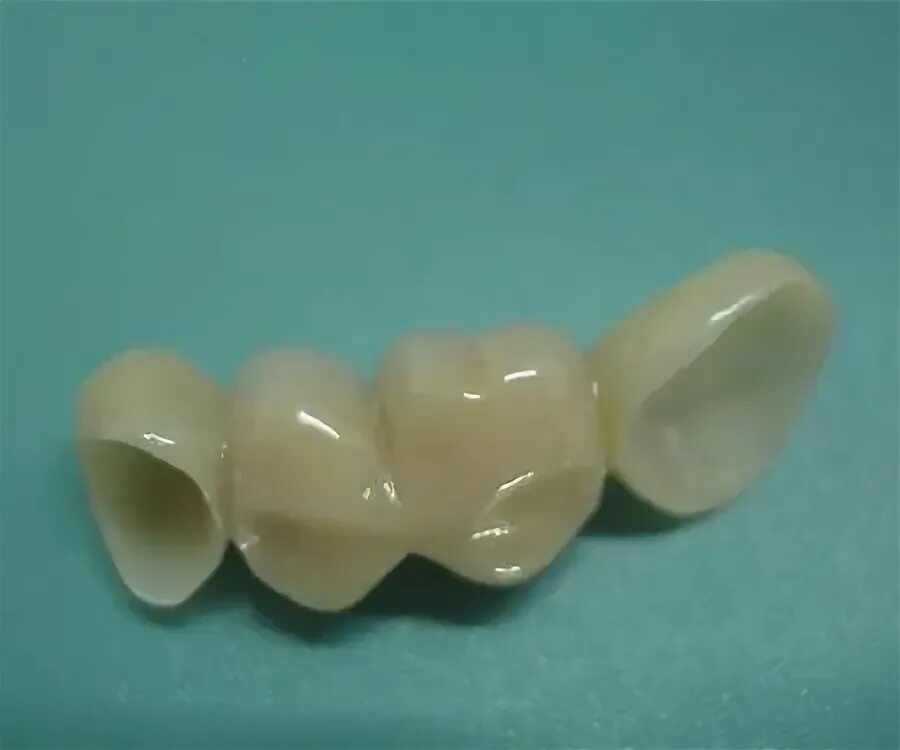 Зубные колпачки