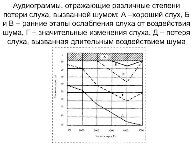 Аудиограмма степени. Тугоухость 4 степени аудиометрия. Нейросенсорная тугоухость 1 степени аудиограмма. Аудиометрия при нейросенсорной тугоухости 1 степени. Аудиограмма 4 степени тугоухости.