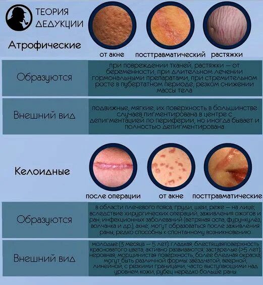 Описание шрама