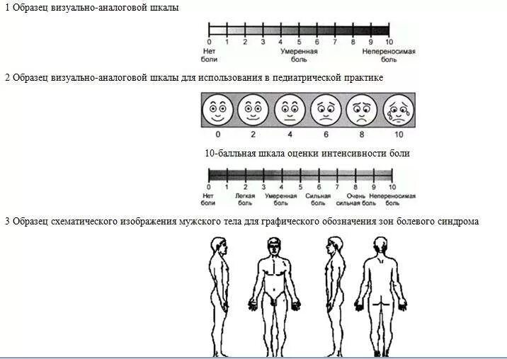 Уровни боли у человека. Оценка интенсивности боли алгоритм. Визуальная аналоговая шкала vas. Визуально-аналоговая шкала болевого синдрома. Оценка боли по шкале боли.
