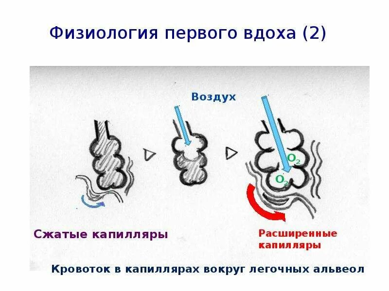 Механизм вдоха новорожденного схема. Механизм первого вдоха новорожденного. Первый вдох новорожденного механизм. Механизм первого вдоха новорожденного физиология. С первым вдохом