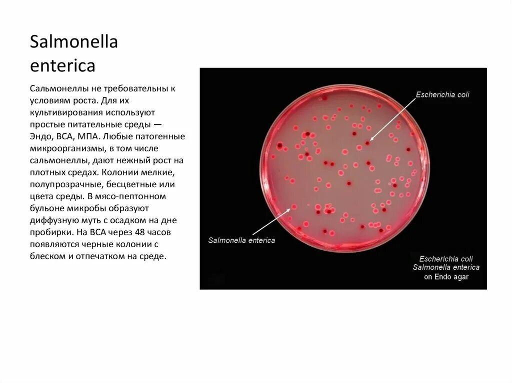 Salmonella enterica на среде Эндо. Сальмонеллы в среде Эндо микробиология. Сальмонелла энтерика микробиология. Сальмонелла на питательных средах. Salmonella enterica