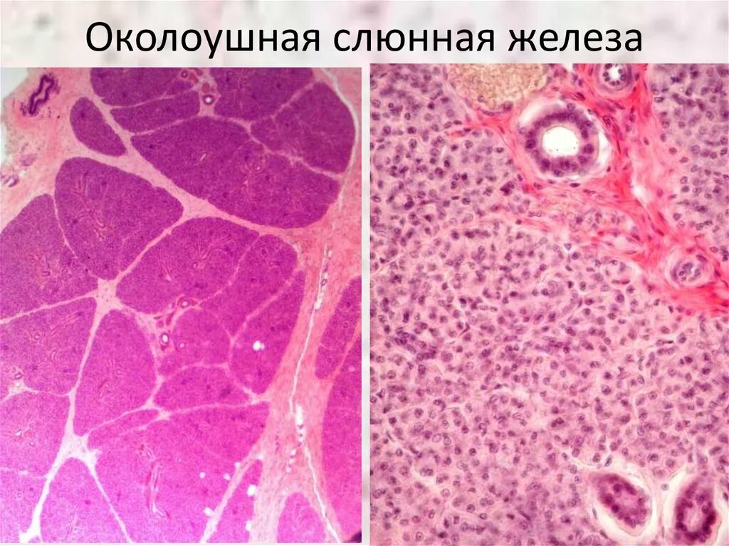 Препарат околоушной железы. Околоушная железа гистология препарат. Слюнные железы гистология препарат. Околоушная слюнная железа гистология препарат. Поднижнечелюстной железы гистология.